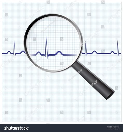 Heart Checkup Magnifying Glass On Ecg Stock Vector Royalty Free