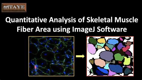 Quantitative Analysis Of Skeletal Muscle Fiber Area Using ImageJ