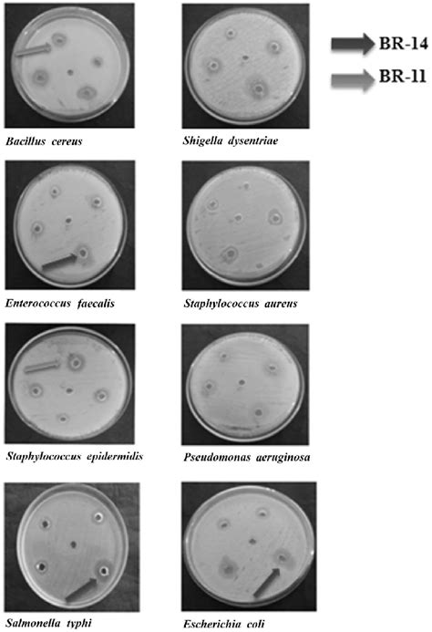 Plates Showing Zone Of Inhibition Against Clinical Pathogens