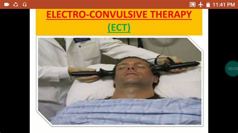 Electro Convulsive Therapyectphysical Therapy In Psychiatry