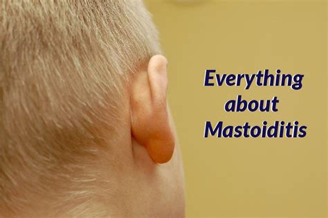 Mastoiditis