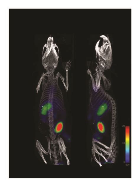 A PET CT Imaging Of Subcutaneous Melanoma Bearing Mice 1 Hour After