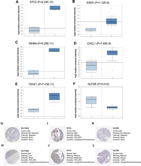 External Verification Of Irgs Expression In Tumor And Normal Tissues