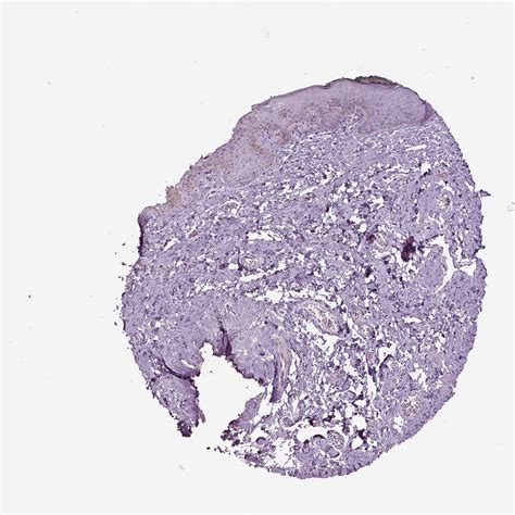 Tissue Expression Of Th Staining In Skin The Human Protein Atlas