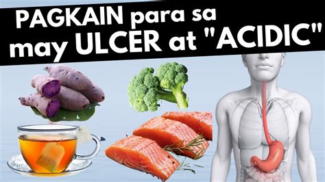 Pagkain Pwede Sa Acidic Mosop