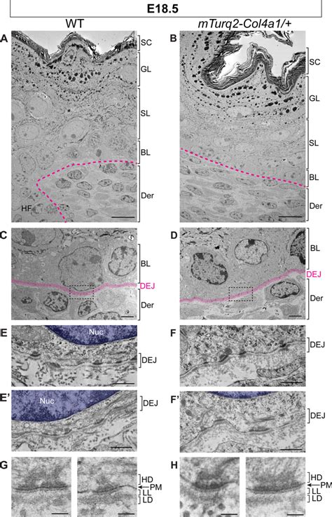 Normal Ultrastructural Organization Of The Epidermis And Download