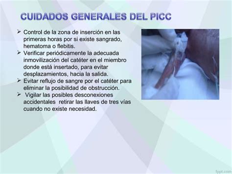 Exposicion Mantenimiento Y Cuidado Del Picc Ppt