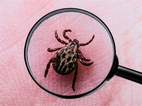 What Nurses Need To Know About Lyme Disease