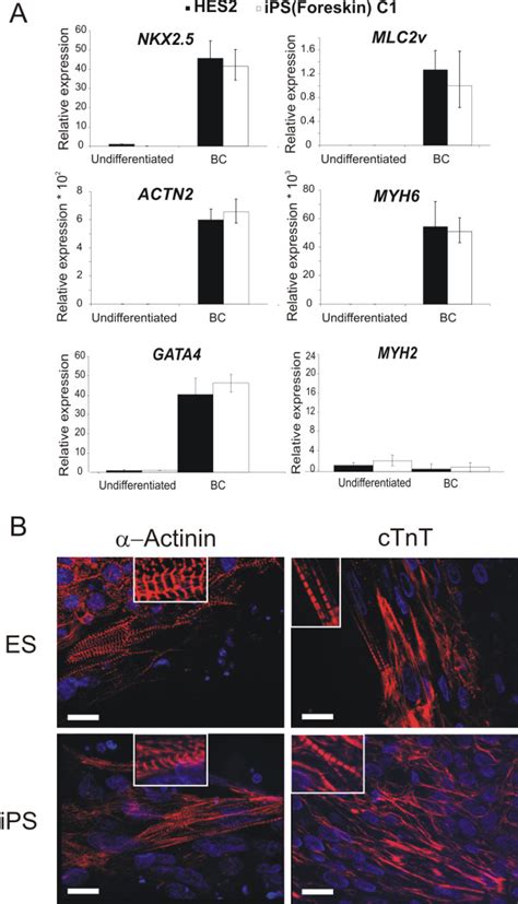 Expression Of Cardiac Transcripts And Proteins In Cardiomyocytes