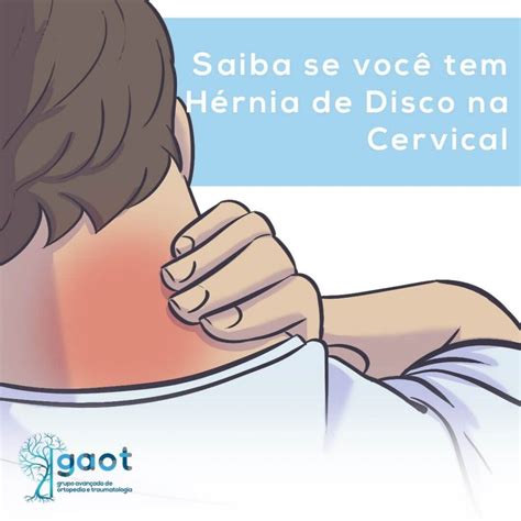 Saiba Se Voc Tem H Rnia De Disco Cervical Gaot