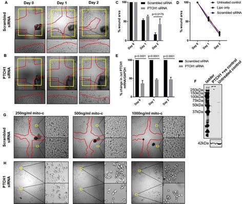 Ptch Expression Regulates Cell Proliferation And Adhesion