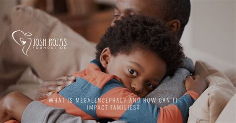 What is Megalencephaly and How Can it Impact Families? | Josh Rojas ...