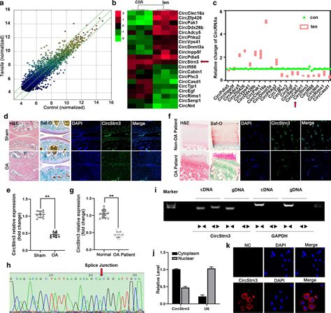 Developmental Endothelial Locus Attenuates Palmitate Induced