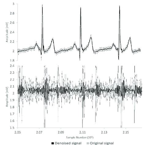 Original And De Noised Electrocardiogram Ecg And Phonocardiogram