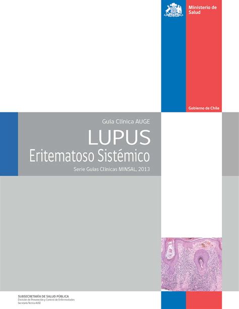 Lupus Eritematoso Sistémico Ministerio De Salud Guía Clínica Auge