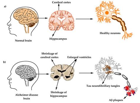 Molecules Free Full Text Comprehensive Review On Alzheimers