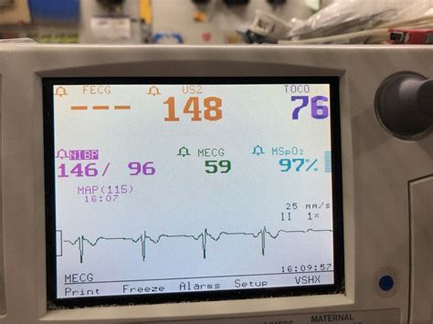 Ge Healthcare Corometrics Cx Series Maternal Fetal Monitor