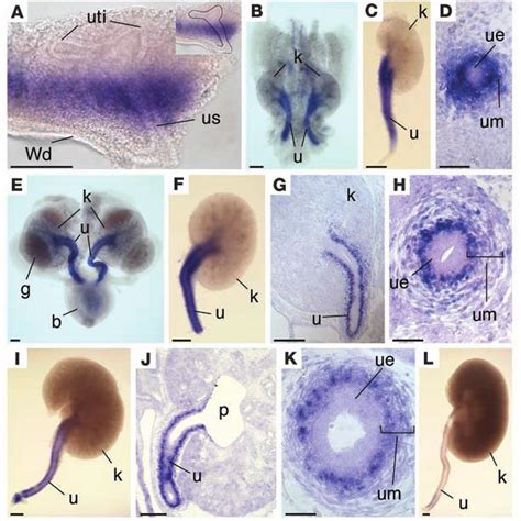 (PDF) Tbx18 regulates the development of the ureteral mesenchyme