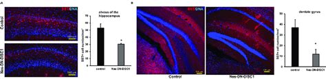 Decreased Sst Interneuron Number In Different Brain Regions Dn Disc1