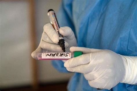 La C Te Divoire Fait Tat De Nouveaux Cas De Mpox Dont Un Mortel