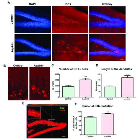 Immunohistochemical Assessment Of Immature Neurons A Representative