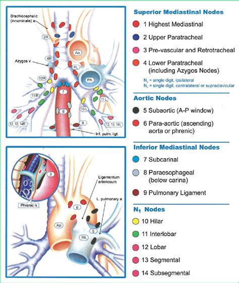 Figure 1 From Mediastinais Transbronchial Needle Aspiration Of Hilar