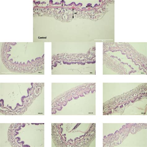 Intestine Tissue Of L Vannamei Stained With He After The Shrimps Were