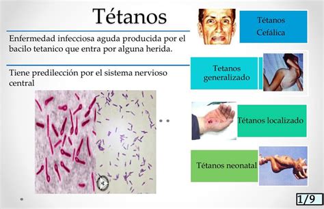 Cadena epidemiológica tétanos Rosario Gutiérrez uDocz