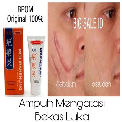 Vicell Meilibahenling Nutritive Cream Penghilang Bekas Luka Bpom Ml