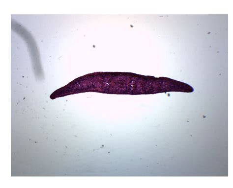 Planaria 3 Different Regions Cross Section Prepared Microscope