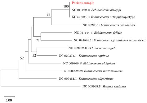 The Phylogenetic Trees Of Echinococcus Spp Based On Cox1 Genes Showed