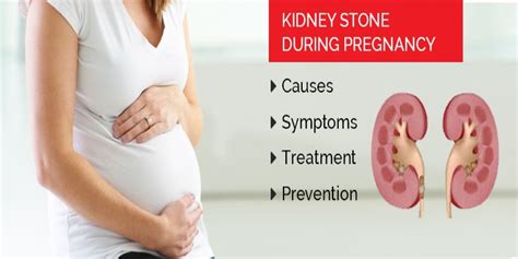 How To Deal With A Kidney Stent - Percutaneous Nephrolithotomy Pcnl My ...