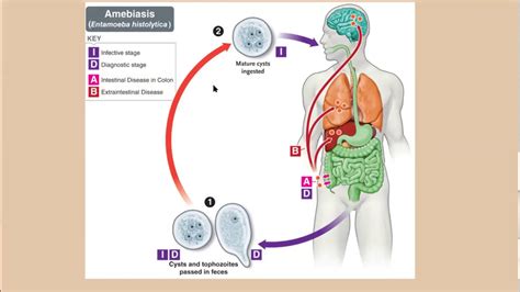 Amebiasis Intestinal 1 Youtube