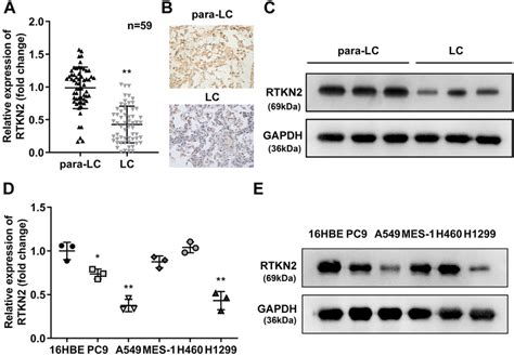 Rtkn Was Downregulated In Luad Tissues And Cells The Rtkn Levels In