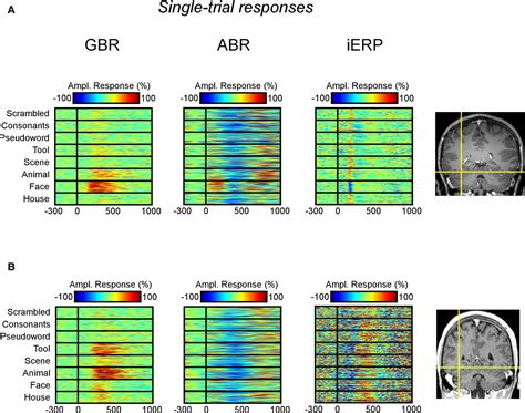 Frontiers Category Specific Visual Responses An Intracranial Study