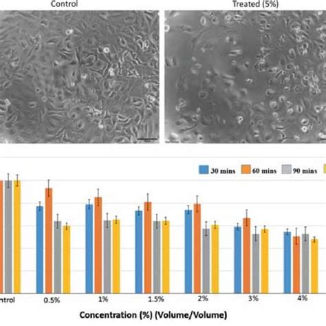 Mtt Assay For Cytotoxicity Of Nps In Noncancerous Nih T Cell