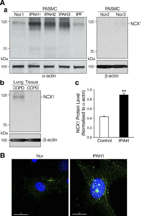 The Na Ca Exchanger Ncx Isoform Of Na Ca Exchanger