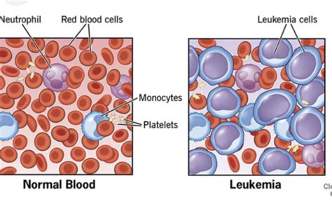 Hematology Flashcards Quizlet