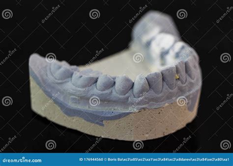 Lower Front Incisor Baby Tooth Gap Showing Gums And Socket Stock Image ...