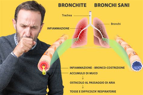 Bronchite Cause E Sintomi Cosa Fare Cure Rimedi