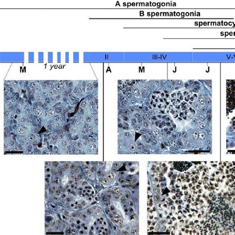 Light Microscopy Observations Of Testicular Tissue Along The