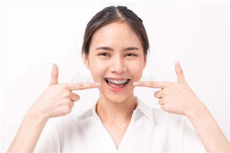 Face Of A Young Smiling Asian Woman With Braces On Teeth Orthodontic Treatment Stock Image