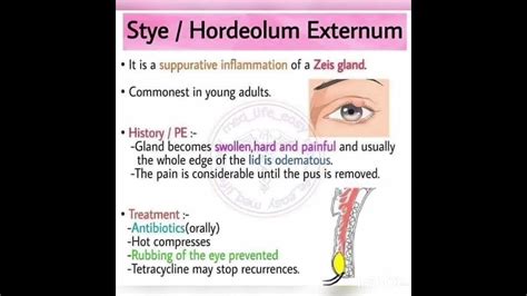 👒 Stye / Hordeolum externum 👒 - YouTube