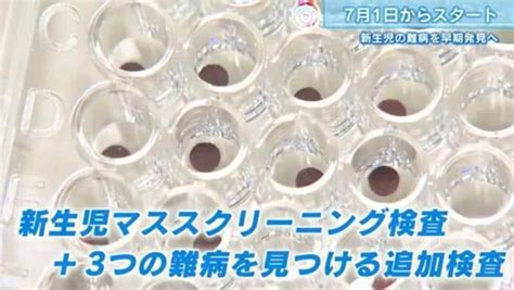 赤ちゃんの命守る「マススクリーニング検査」 少量の血液で難病を早期発見し治療へ新たに3項目が追加【広島発】｜fnnプライムオンライン