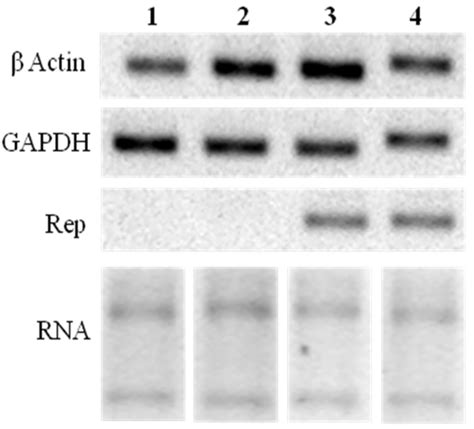 Viruses | Special Issue : Plant Viruses