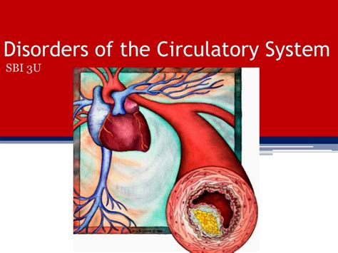 Ppt Disorders Of The Circulatory System Powerpoint Presentation Free