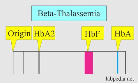 Hemoglobin Part 2 Hemoglobin Hb Electrophoresis Labpedia Net