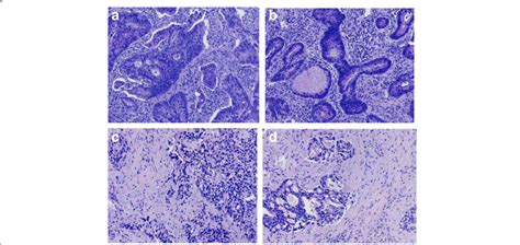 Pathological Features Of The Tumor Specimens In Each Group HCT 116