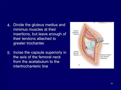 Hip Arthroplasty Approach.pdf