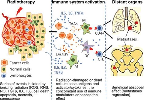 The Abscopal Effect Irradiation Of Tumor Cells Results In The Release